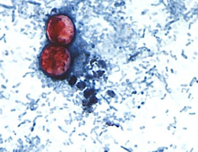 #Cyclospora